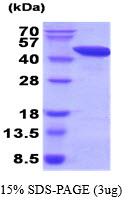 3ug by SDS-PAGE under reducing condition and visualized by coomassie blue stain.