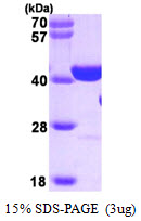 3ug by SDS-PAGE under reducing condition and visualized by coomassie blue stain.