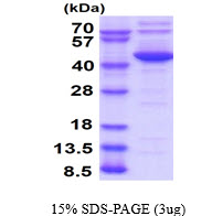 3ug by SDS-PAGE under reducing condition and visualized by coomassie blue stain.