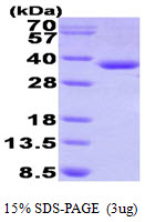 3ug by SDS-PAGE under reducing condition and visualized by coomassie blue stain.