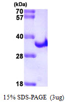 3ug by SDS-PAGE under reducing condition and visualized by coomassie blue stain.