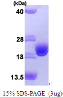 3ug by SDS-PAGE under reducing condition and visualized by coomassie blue stain.