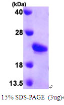 3ug by SDS-PAGE under reducing condition and visualized by coomassie blue stain.