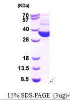 3ug by SDS-PAGE under reducing condition and visualized by coomassie blue stain.