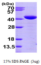 3ug by SDS-PAGE under reducing condition and visualized by coomassie blue stain.