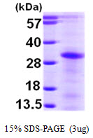 3ug by SDS-PAGE under reducing condition and visualized by coomassie blue stain.