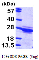 3ug by SDS-PAGE under reducing condition and visualized by coomassie blue stain.