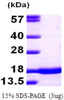 3ug by SDS-PAGE under reducing condition and visualized by coomassie blue stain.