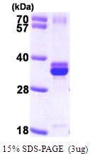 3ug by SDS-PAGE under reducing condition and visualized by coomassie blue stain.