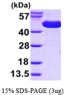 3ug by SDS-PAGE under reducing condition and visualized by coomassie blue stain.