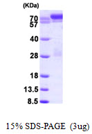 3ug by SDS-PAGE under reducing condition and visualized by coomassie blue stain.