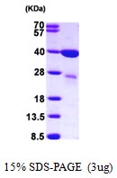 3ug by SDS-PAGE under reducing condition and visualized by coomassie blue stain.