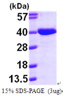 3ug by SDS-PAGE under reducing condition and visualized by coomassie blue stain.