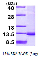 3ug by SDS-PAGE under reducing condition and visualized by coomassie blue stain.