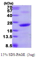 3ug by SDS-PAGE under reducing condition and visualized by coomassie blue stain.