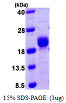 3ug by SDS-PAGE under reducing condition and visualized by coomassie blue stain.