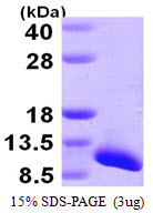 3ug by SDS-PAGE under reducing condition and visualized by coomassie blue stain.