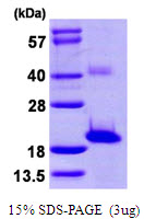 3ug by SDS-PAGE under reducing condition and visualized by coomassie blue stain.