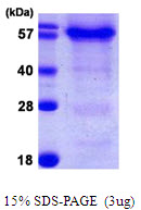 3ug by SDS-PAGE under reducing condition and visualized by coomassie blue stain.