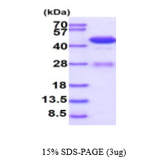 3ug by SDS-PAGE under reducing condition and visualized by coomassie blue stain.