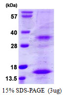 3ug by SDS-PAGE under reducing condition and visualized by coomassie blue stain.