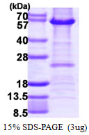 3ug by SDS-PAGE under reducing condition and visualized by coomassie blue stain.