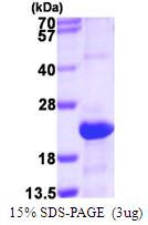 3ug by SDS-PAGE under reducing condition and visualized by coomassie blue stain.