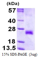 3ug by SDS-PAGE under reducing condition and visualized by coomassie blue stain.