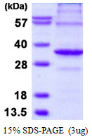 3ug by SDS-PAGE under reducing condition and visualized by coomassie blue stain.