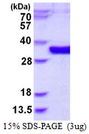 3ug by SDS-PAGE under reducing condition and visualized by coomassie blue stain.