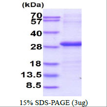 3ug by SDS-PAGE under reducing condition and visualized by coomassie blue stain.