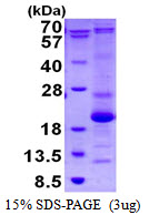 3ug by SDS-PAGE under reducing condition and visualized by coomassie blue stain.