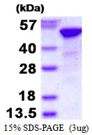 3ug by SDS-PAGE under reducing condition and visualized by coomassie blue stain.