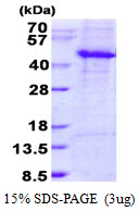 3ug by SDS-PAGE under reducing condition and visualized by coomassie blue stain.