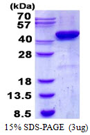 3ug by SDS-PAGE under reducing condition and visualized by coomassie blue stain.