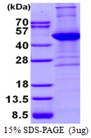 3ug by SDS-PAGE under reducing condition and visualized by coomassie blue stain.