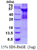 3ug by SDS-PAGE under reducing condition and visualized by coomassie blue stain.