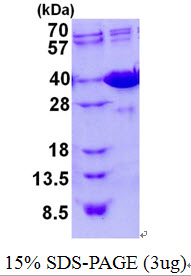 3ug by SDS-PAGE under reducing condition and visualized by coomassie blue stain.