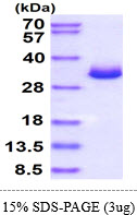 3ug by SDS-PAGE under reducing condition and visualized by coomassie blue stain.