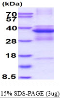 3ug by SDS-PAGE under reducing condition and visualized by coomassie blue stain.