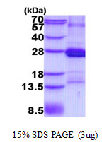 3ug by SDS-PAGE under reducing condition and visualized by coomassie blue stain.