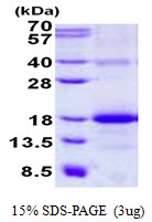 3ug by SDS-PAGE under reducing condition and visualized by coomassie blue stain.