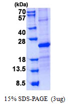 3ug by SDS-PAGE under reducing condition and visualized by coomassie blue stain.