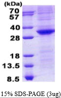 3ug by SDS-PAGE under reducing condition and visualized by coomassie blue stain.