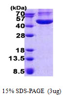 3ug by SDS-PAGE under reducing condition and visualized by coomassie blue stain.