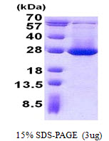 3ug by SDS-PAGE under reducing condition and visualized by coomassie blue stain.