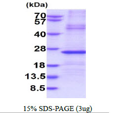 3ug by SDS-PAGE under reducing condition and visualized by coomassie blue stain.