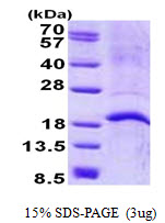 3ug by SDS-PAGE under reducing condition and visualized by coomassie blue stain.