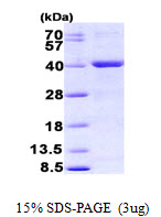 3ug by SDS-PAGE under reducing condition and visualized by coomassie blue stain.