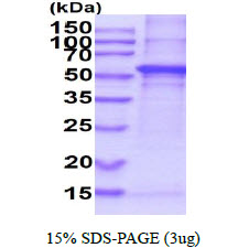 3ug by SDS-PAGE under reducing condition and visualized by coomassie blue stain.